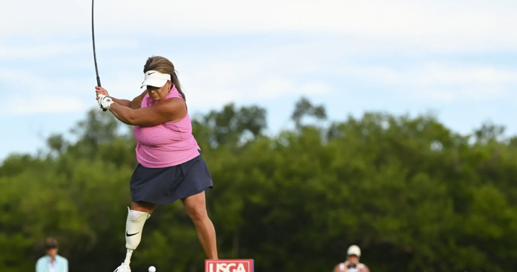 A rare disease cost a Nebraska woman her leg. Now she’s competing for a national golf championship