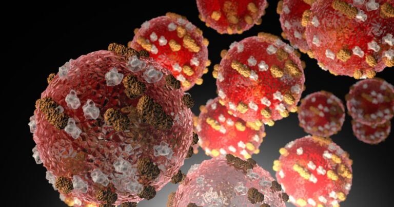 Three measles cases confirmed in Buncombe County as officials track chickenpox and whooping cough