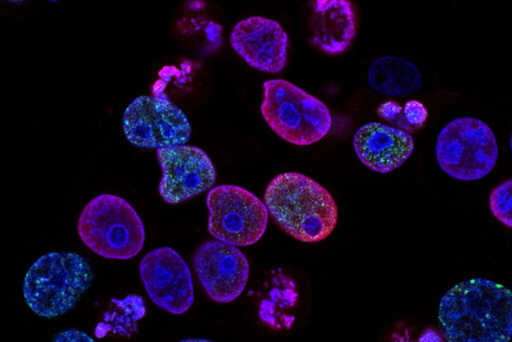 Revolutionary therapy treats ‘untreatable’ blood cancer