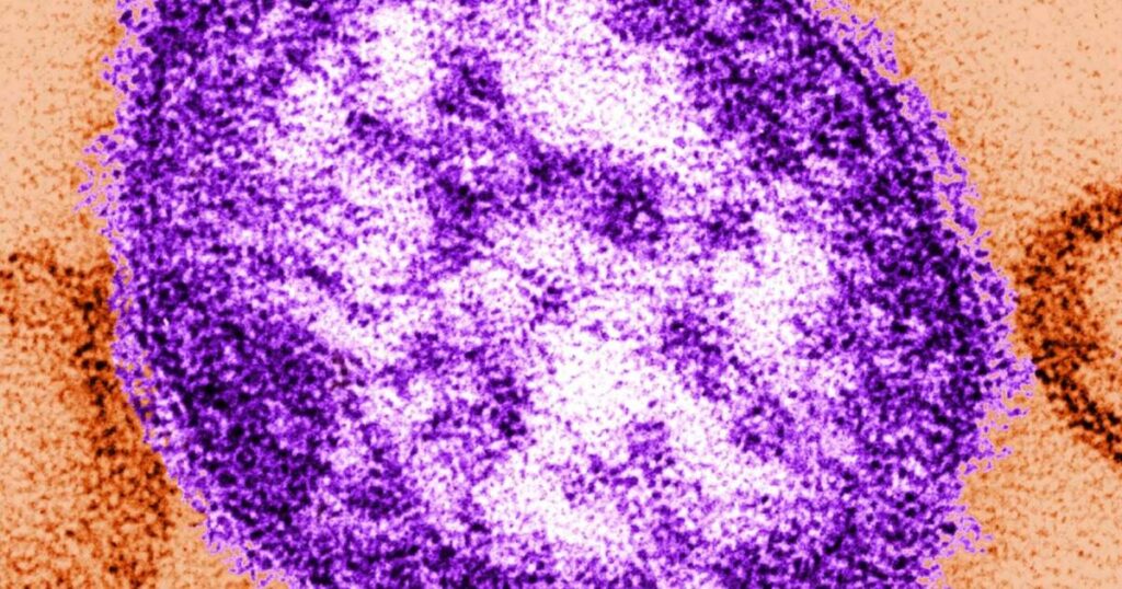Two unvaccinated Pennsylvanians die after contracting measles as outbreak reaches nearly 400 cases