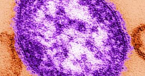 Two unvaccinated Pennsylvanians die after contracting measles as outbreak reaches nearly 400 cases