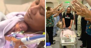 Miracle Baby Born Smaller Than Soda Can Becomes Australias Most - Common Good News miracle baby born smaller than soda can