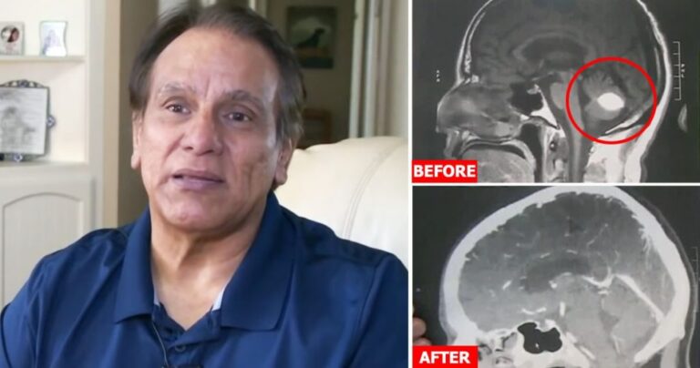 Brain Tumor Miraculously Disappears On Day Of Surgery And Doctors Can't Explain