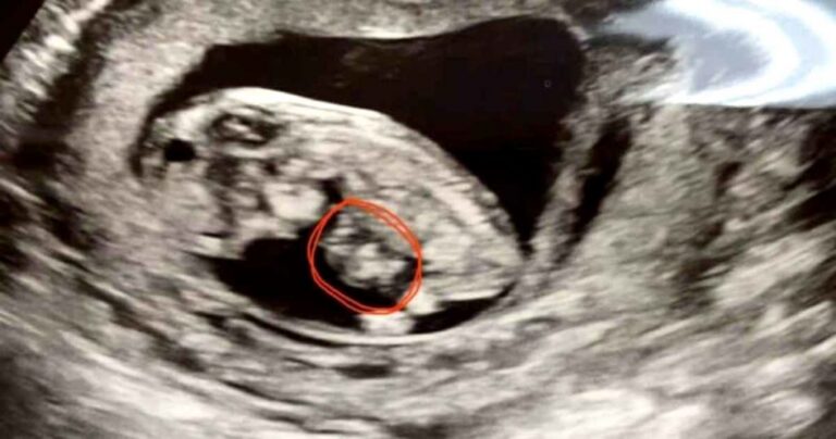 miracle-baby-rachel-jenkins