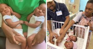 rare momo twins born holding each other