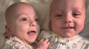 These Ultra Rare 'Mono Mono' Twins Beat Incredible Odds and Are Now Thriving