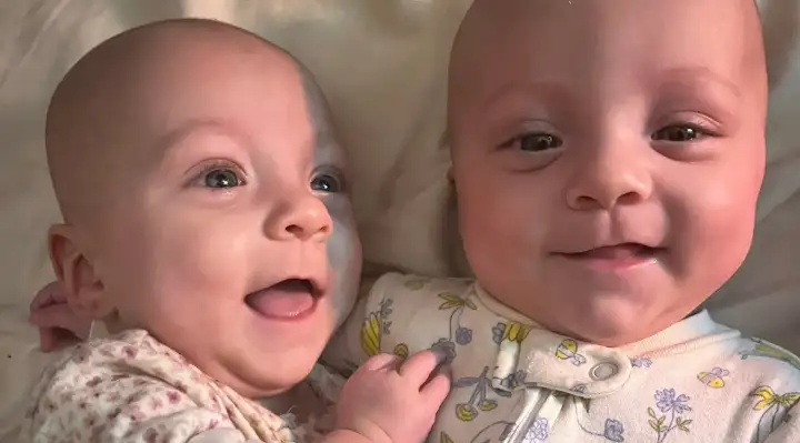 These Ultra Rare 'Mono Mono' Twins Beat Incredible Odds and Are Now Thriving