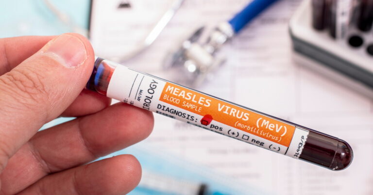 Five more measles cases confirmed in Georgia